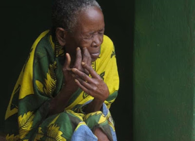 9 Old Woman affected by Leprosy in Tanzania